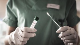 Breaking News // Încă 151 de moldoveni au fost testați pozitiv cu COVID-19. Bilanțul a ajuns la 6.704