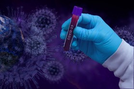 Ultima oră // Încă 300 cazuri noi de infectare cu COVID-19. Bilanțul total a ajuns la 20.794