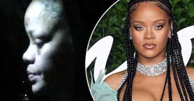 FOTO // Rihanna, fotografiată cu vânătăi pe față. Prima reacție a reprezentanților artistei
