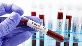 Breaking News // Încă 777 persoane au fost testate pozitiv cu COVID-19. Bilanțul a ajuns la 689.568