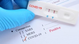 Breaking News // Încă 308 persoane au fost testate pozitiv cu COVID-19. Bilanțul a ajuns la 71.811