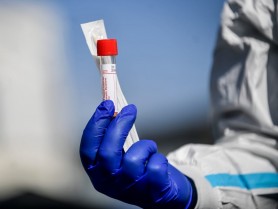 RECORD ABSOLUT // Încă 1.727 persoane au fost testate pozitiv cu COVID-19. Bilanțul a ajuns la 112.307