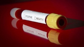 Breaking News // Încă 1.130 persoane au fost testate pozitiv cu COVID-19. Bilanțul a ajuns la 117.495
