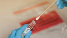 Testare COVID gratuită, timp de o lună, pentru cetățenii din Cehia care vor să vadă dacă sunt infectați
