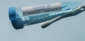Breaking News // Încă 1.222 persoane au fost testate pozitiv cu COVID-19. Bilanțul a ajuns la 139.435