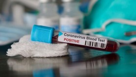 Ultima oră // 394 de cazuri noi de îmbolnăvire cu COVID-19 în ultimele 24 de ore