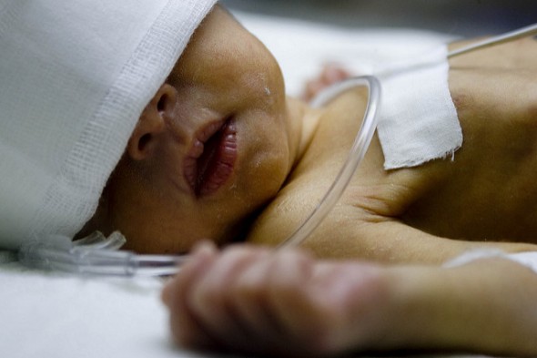 Fetiţă de 40 de zile, în comă la spital. Medicii au găsit urme de metadonă şi cocaină în organismul micuţei