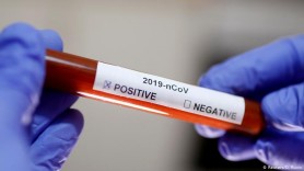COVID-19 în Moldova: Alte 1843 cazuri noi de infectare iar 29 de persoane au fost răpuse de virus