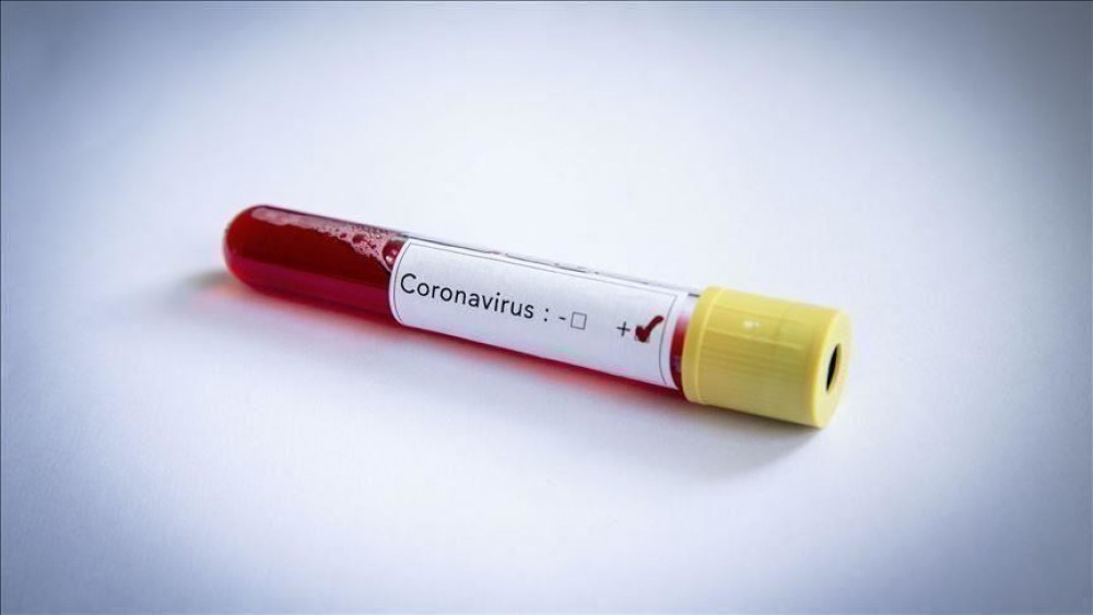 FLASH // MedLife: 93 din 94 de probe provenite din Moldova sunt cu tulpina britanică a coronavirusului