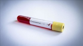 FLASH // MedLife: 93 din 94 de probe provenite din Moldova sunt cu tulpina britanică a coronavirusului