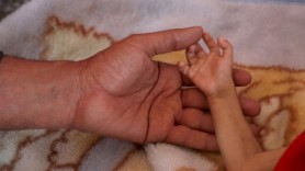 Miracolul de la Brașov: O fetiță înecată s-a „întors din morți” după două ore de resuscitări