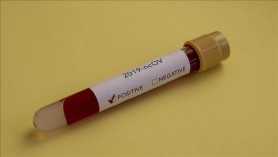 Breaking News // Încă 260 persoane au fost testate pozitiv cu COVID-19. Bilanțul a ajuns la 252.413
