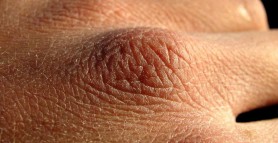 Îngrijirea mâinilor. 5 remedii naturale pentru mâini uscate și crăpate