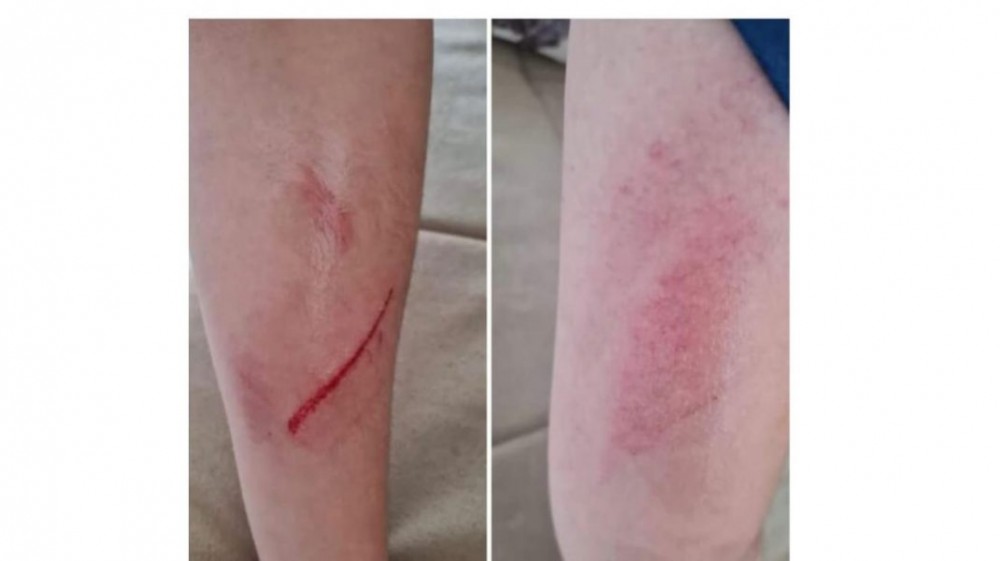 Strigător la cer: Un copil a fost lovit și umilit de colegi, „pe motiv că este grăsuț”