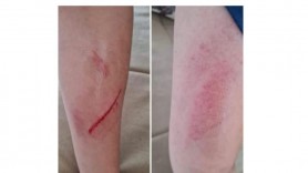 Strigător la cer: Un copil a fost lovit și umilit de colegi, „pe motiv că este grăsuț”