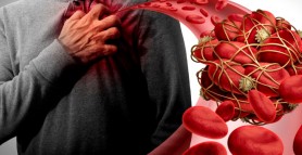 10 alimente și suplimente care subțiază sângele și reduc riscul de cheaguri
