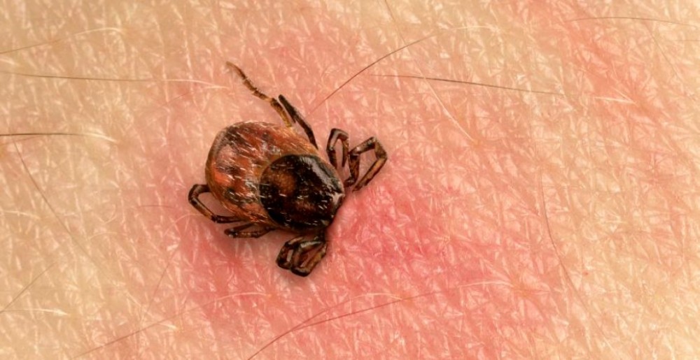Căpușele, purtătoare de virusuri și bacterii foarte periculoase