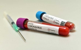 Breaking News // Încă 69 persoane au fost testate pozitiv cu COVID-19. Bilanțul a ajuns la 255 354