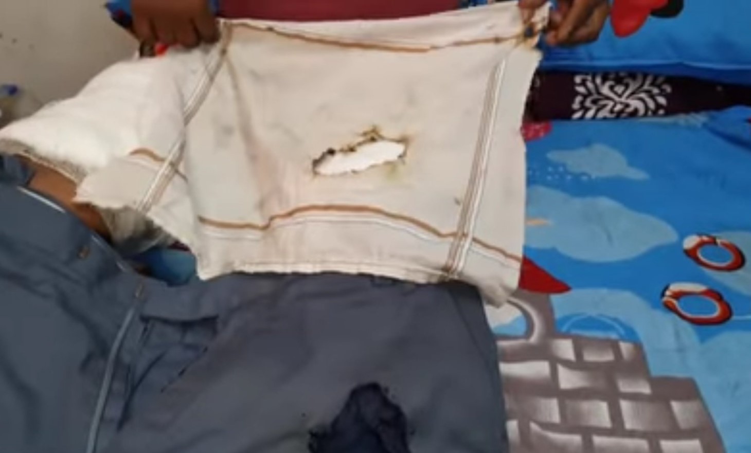 FOTO/VIDEO: Bărbat, rănit după ce i-a explodat smartphone-ul în buzunar. Modelul, vândut și în Moldova
