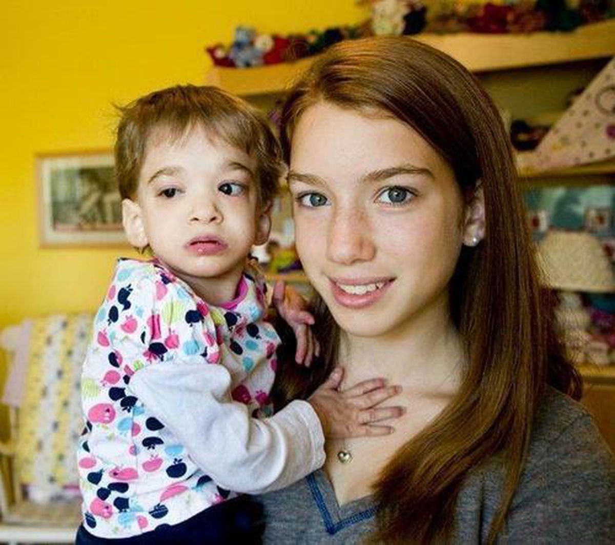 Fetița care nu a îmbătrânit niciodată. Cazul bizar care a șocat lumea medicală