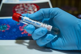 Breaking News // Încă 60 persoane au fost testate pozitiv cu COVID-19. Bilanțul a ajuns la 256 054