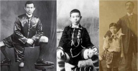 FOTO // 5 oameni care au intrat în istorie cu aspectul lor neobișnuit. Aceste cazuri au uimit lumea medicală