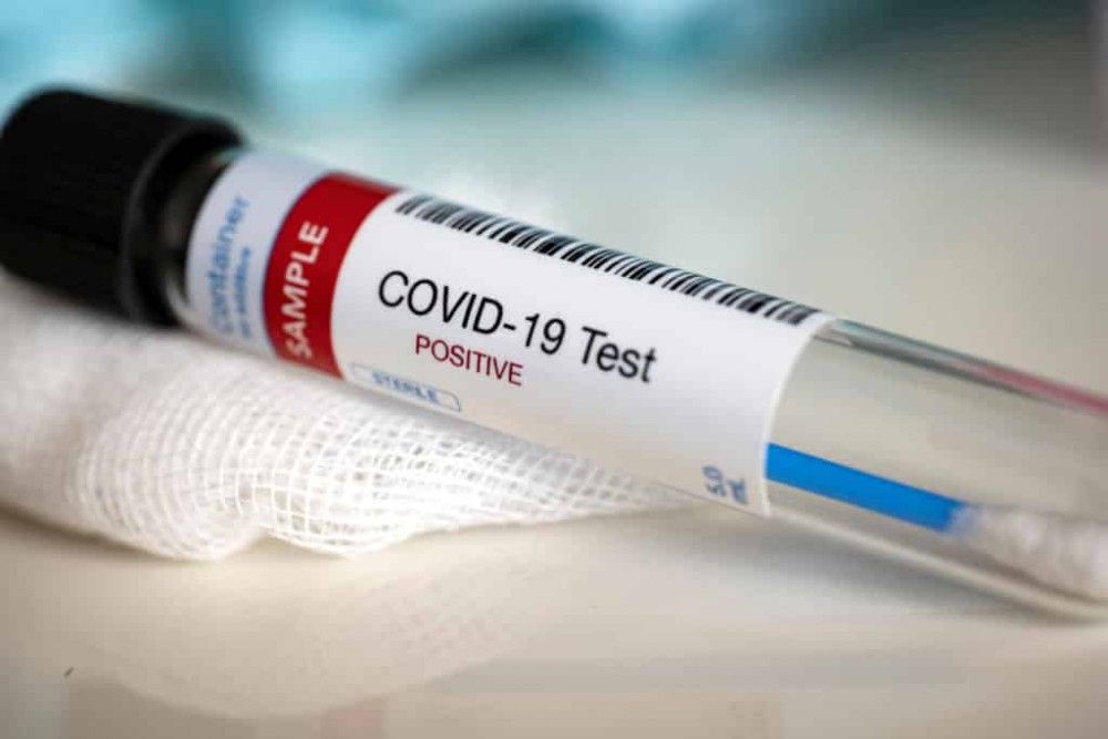 Breaking News // Încă 63 persoane au fost testate pozitiv cu COVID-19. Bilanțul a ajuns la 256 387