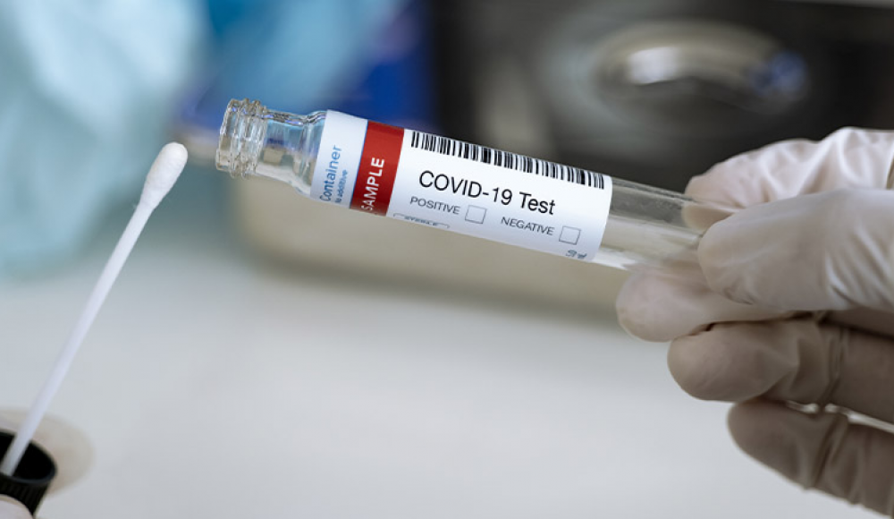 Breaking News // Încă 55 persoane au fost testate pozitiv cu COVID-19. Bilanțul a ajuns la 256 614