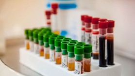 Un nou val de creștere a infecțiilor COVID în Moldova. Care regiuni sunt cele mai afectate