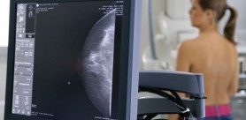 Aspirina ar putea ajuta la tratarea formelor agresive de cancer la sân