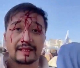 Un cetățean australian a fost bătut și răpit de talibani: „Sunt cetățean australian. Nu sunt afgan. Nu ai voie să mă lovești”