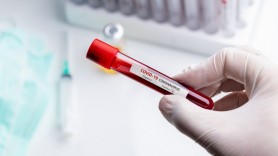 135 de persoane infectate cu COVID se află-n stare EXTREM de GRAVĂ. Alte 1.194 cazuri confirmate în ultimele 24 de ore