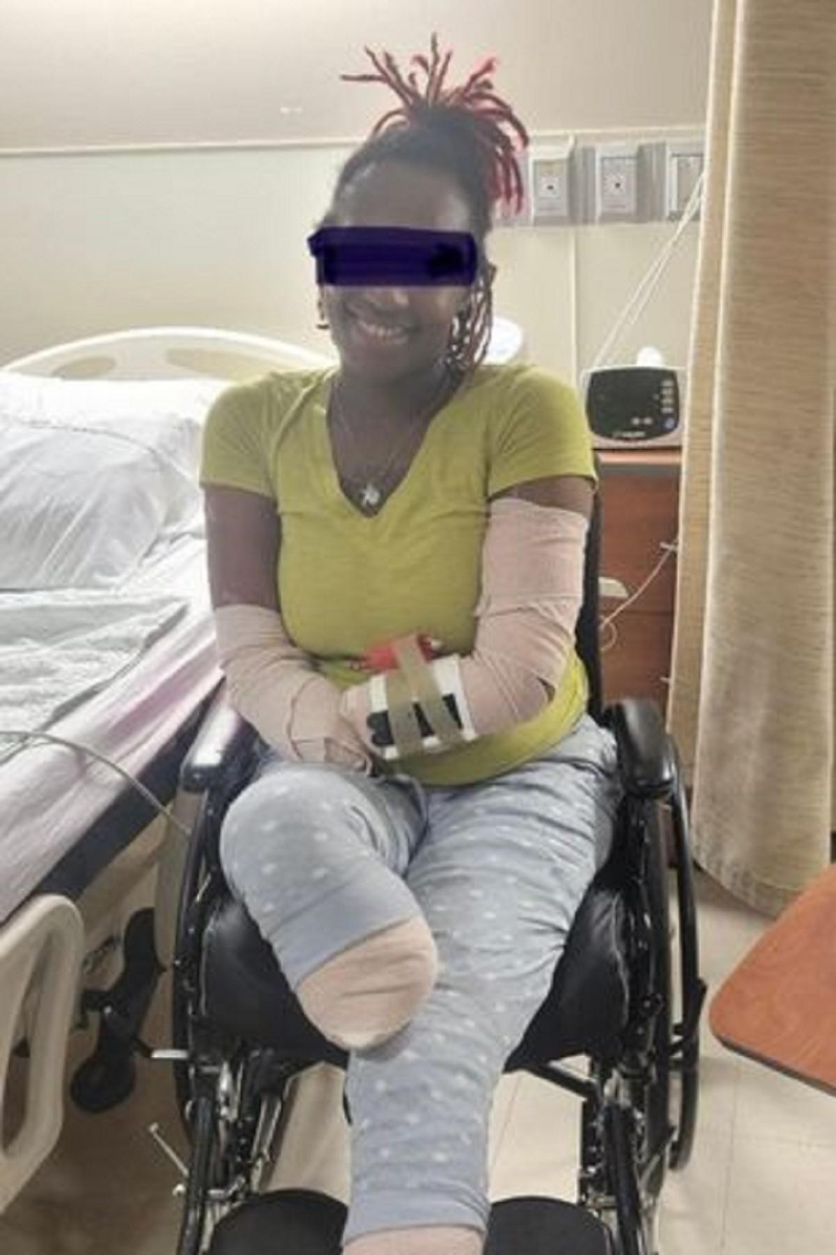 FOTO // O mamă a trei copii şi-a pierdut mâinile şi picioarele în urma unor complicaţii provocate de Covid-19