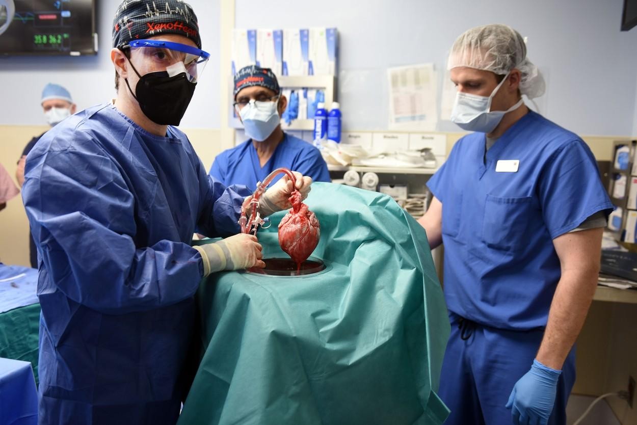 FOTO // Transplant realizat în premieră. Un bărbat a primit inima unui porc