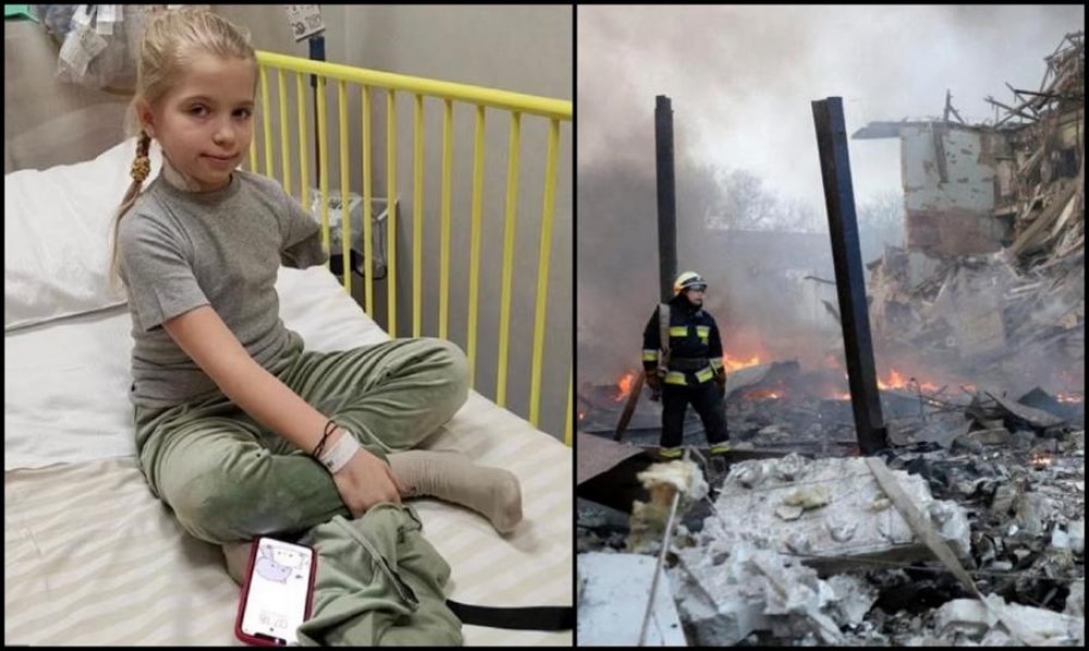 FOTO // Fetiţă de 9 ani, rămasă fără braţ după bombardamentele din Kiev: „Nu știu de ce m-au împușcat rușii”