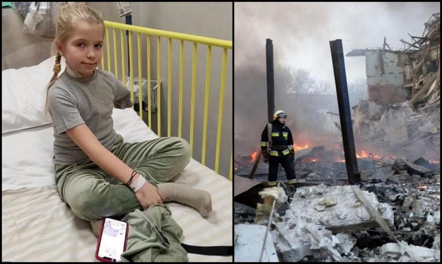 FOTO // Fetiţă de 9 ani, rămasă fără braţ după bombardamentele din Kiev: „Nu știu de ce m-au împușcat rușii”