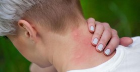 Cum ne protejăm de căpușe și țânțari. Sfaturi și recomandări prețioase direct de la medic