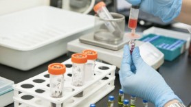 FLASH // China a detectat primul caz de gripă aviară H3N8 la om