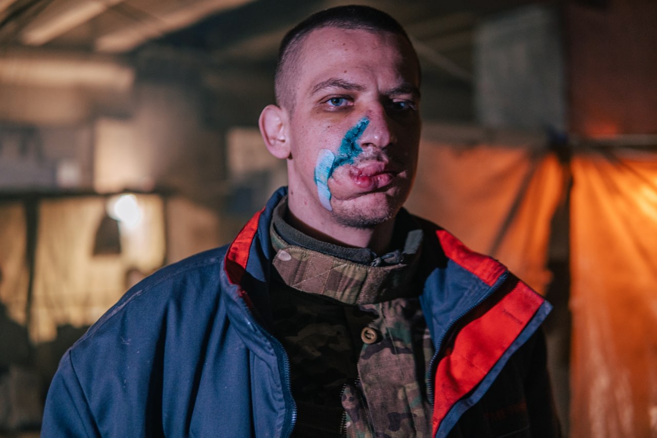 FOTO // Imagini cu soldații ucraineni răniți din catacombele Azovstal: „Întreaga lume civilizată trebuie să vadă”
