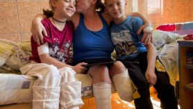 FOTO // Mama și fiica și-au pierdut picioarele într-un bombardament rus. De ele are grijă acum geamănul rămas teafăr