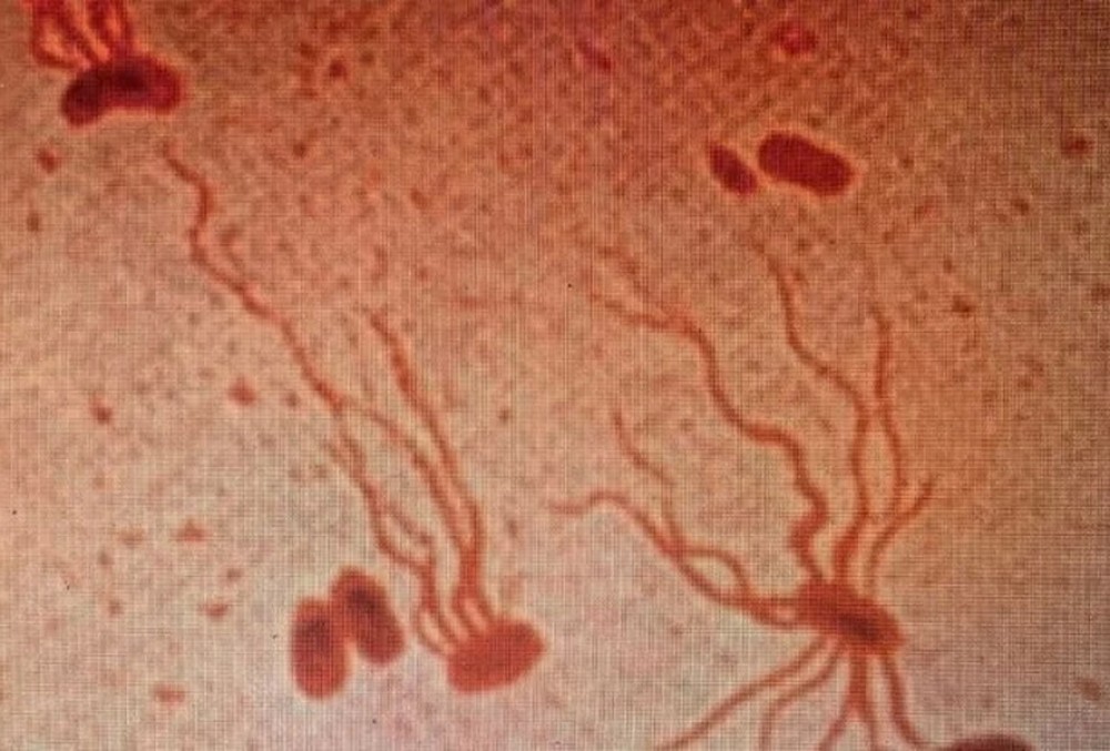 Un virus amenință omenirea: A devenit rezistent la medicamente