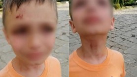 FLASH // Minori bătuți de un Polițist de Frontieră la Basarabeasca. Reacția Ministerului Afacerilor Interne