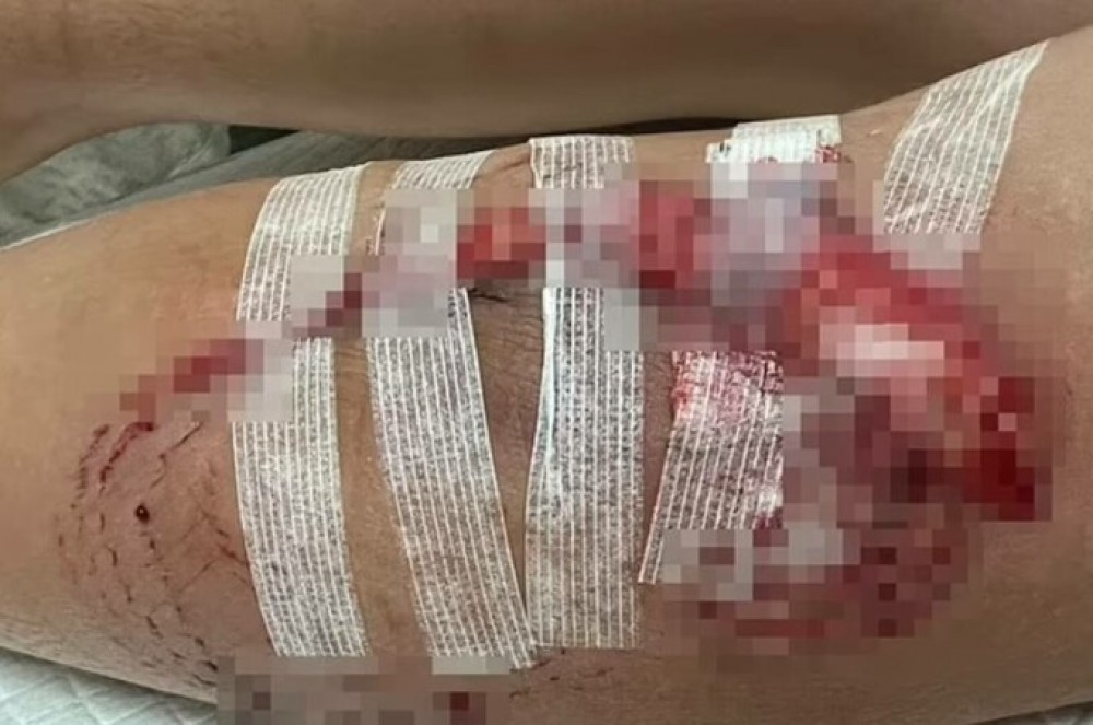 Imagini de GROAZĂ pe o plajă din Caraibe: Un băiețel a fost atacat de trei rechini