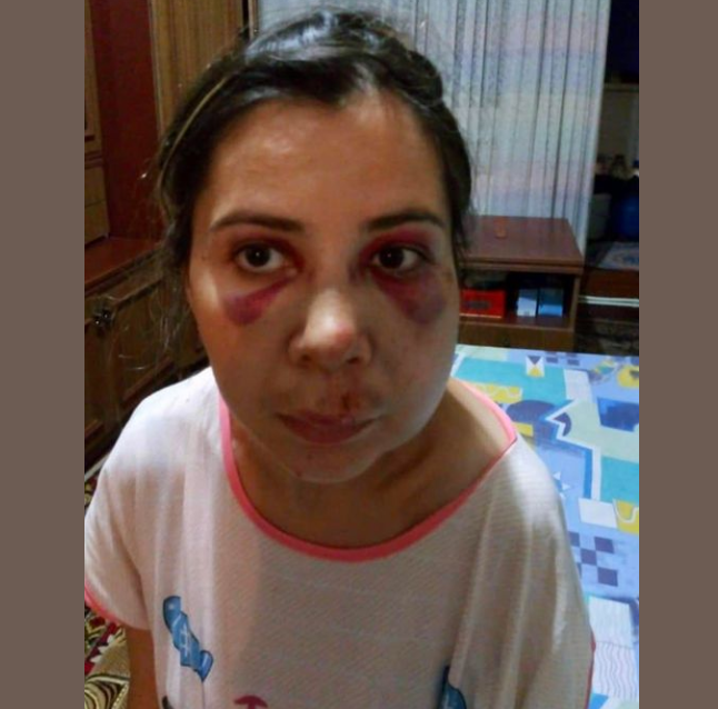 Lovită pe o trecere de pietoni, o poetă din Cimișlia s-a plâns de atitudinea ignorantă a medicilor