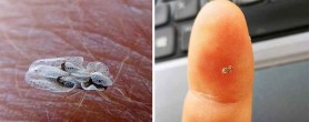 Insecta supărătoare, de „import”, ce „terorizează” moldovenii. Entomolog: Nu se știe ce determină această specie să înțepe oamenii