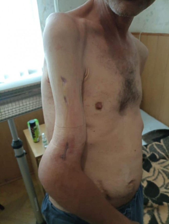 FOTO // Transformarea ȘOCANTĂ a unui militar ucrainean de la Azovstal, după ce a nimerit în captivitate