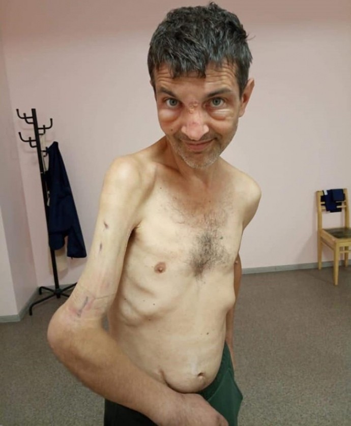 FOTO // Transformarea ȘOCANTĂ a unui militar ucrainean de la Azovstal, după ce a nimerit în captivitate