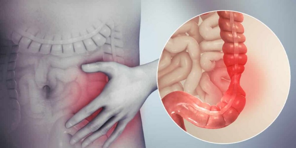 Consumă acest fruct dacă ai colonul inflamat. Este antiinflamator și favorizează recuperarea