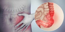 Consumă acest fruct dacă ai colonul inflamat. Este antiinflamator și favorizează recuperarea