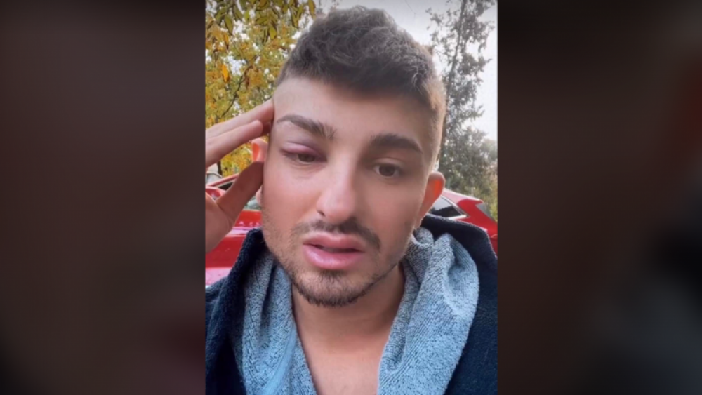 VIDEO // „Sunt în ȘOC!” - Paza unui mall din Chișinău l-au bătut pe Johy Davis. De la ce a pornit scandalul